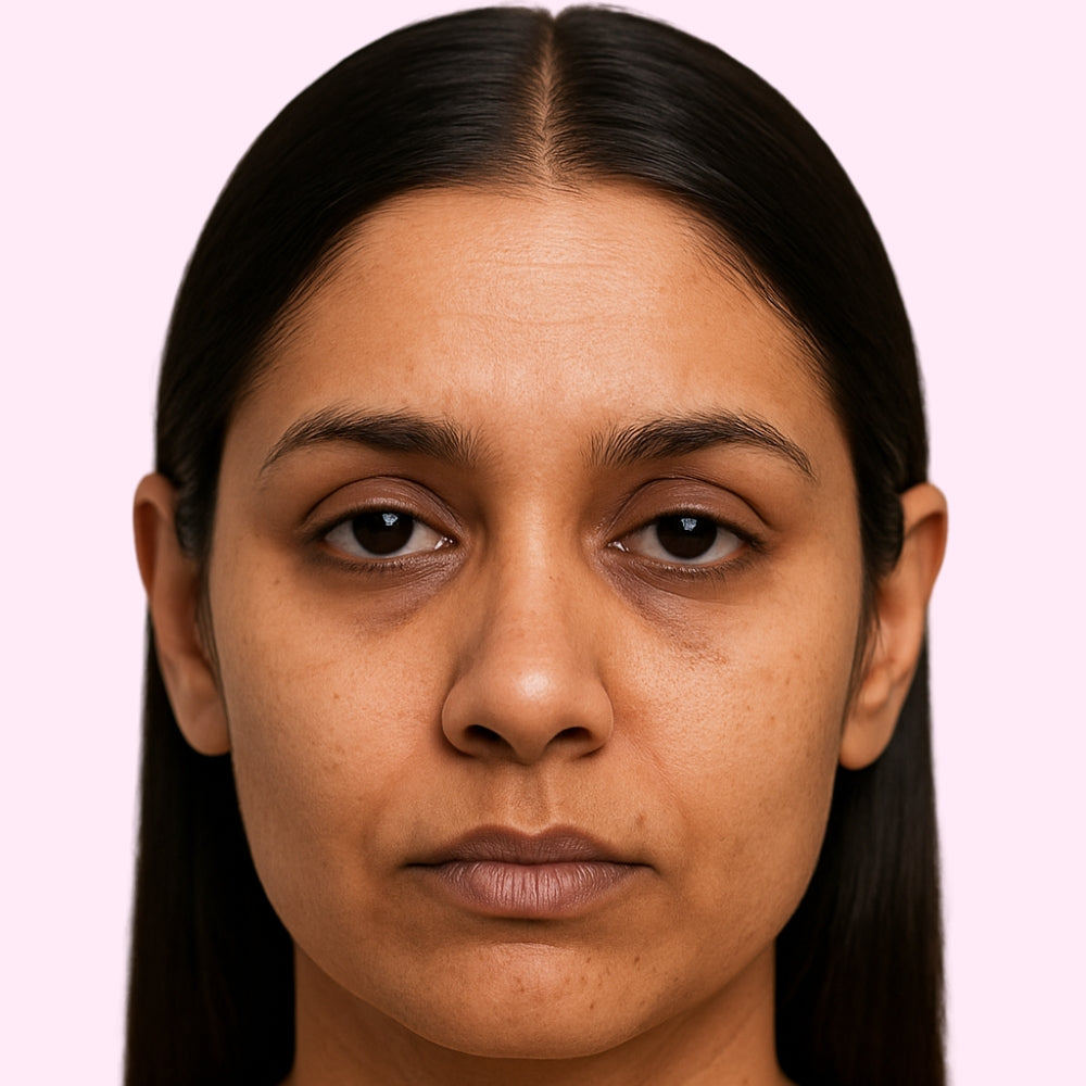 Before – dull skin
